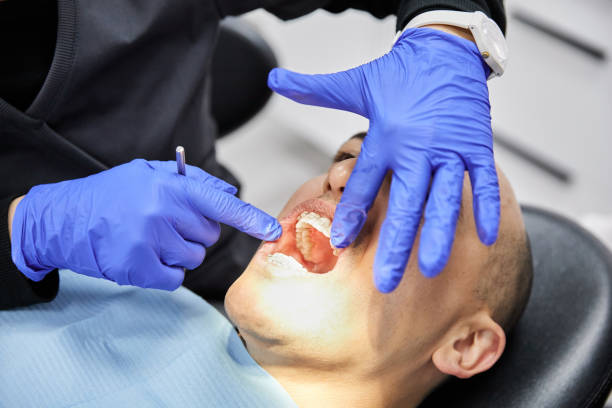 Best Emergency Treatment for Dental Infections or Abscesses in Lansdowne, MD